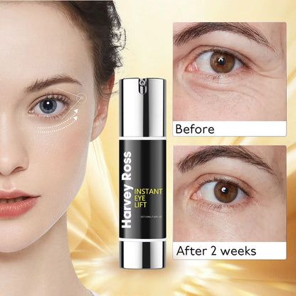 Lifting de ojos instantáneo